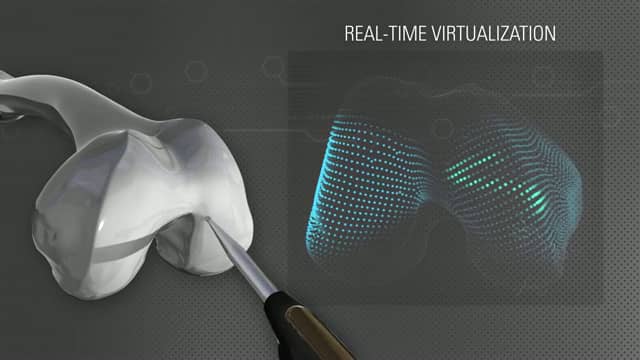 AdvitaGPS Knee used for accuracy and precision