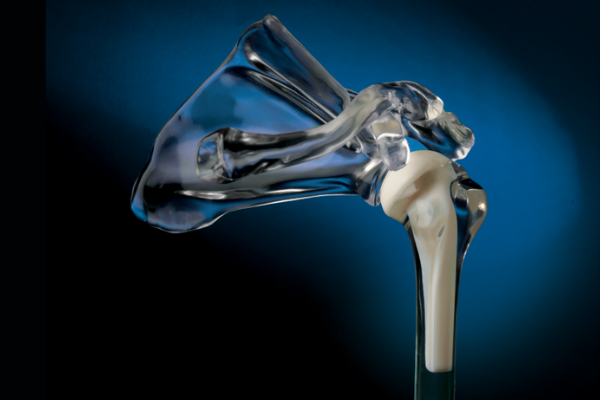 InterSpace Shoulder placed in an acrylic shoulder model