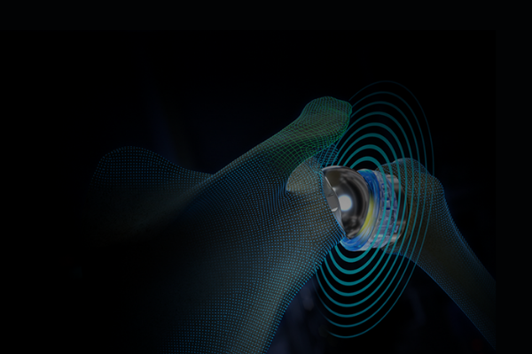 Image is exemplifying what the idea of the future of shoulder arthroplasty with Advita's innovative solutions