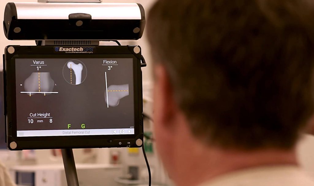 Truliant-Knee-System-Surgeon-AdvitaGPS