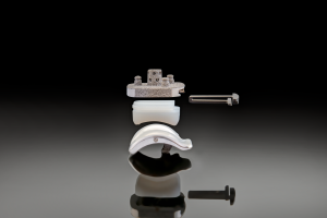 Figure 8. Unique to the Vantage fixed-bearing total ankle system is the locking clip technology that secures the polyethylene to the tibial tray.