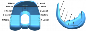 Figure 1. Representative views of the Truliant femoral component demonstrating the 10 anatomical locations for the measurement of component fit.
