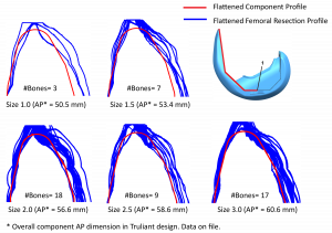 Figure 2. Illustration of “flattened” two dimensional Truliant femoral component profiles for each component size, overlaid with the associated resected femoral bone profiles in the dataset according to the component sizing and placement. The images were scaled to the same size, with the bone profiles truncated to only the region of interest.