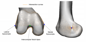 Figure 2. A representative femur illustrating intersecting curves created by rotating a plane around the transepicondylar axis.