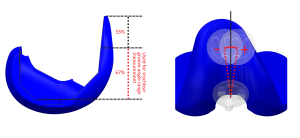 Figure 4. Measurement of the allowed range of trochlear groove orientation on the Truliant design.
