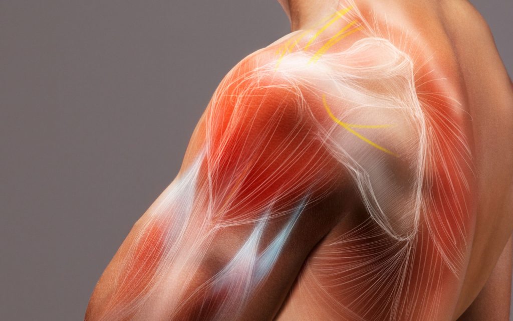 Deltopectoral, superolateral or rotator cuff sparing