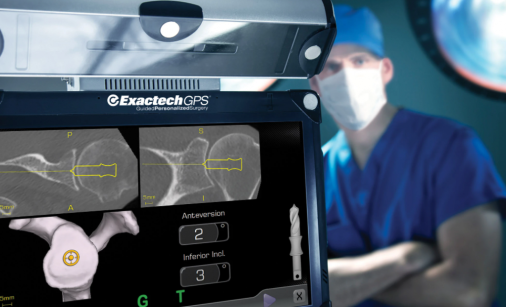 Using GPS to Help with Accurate Glenoid Placement