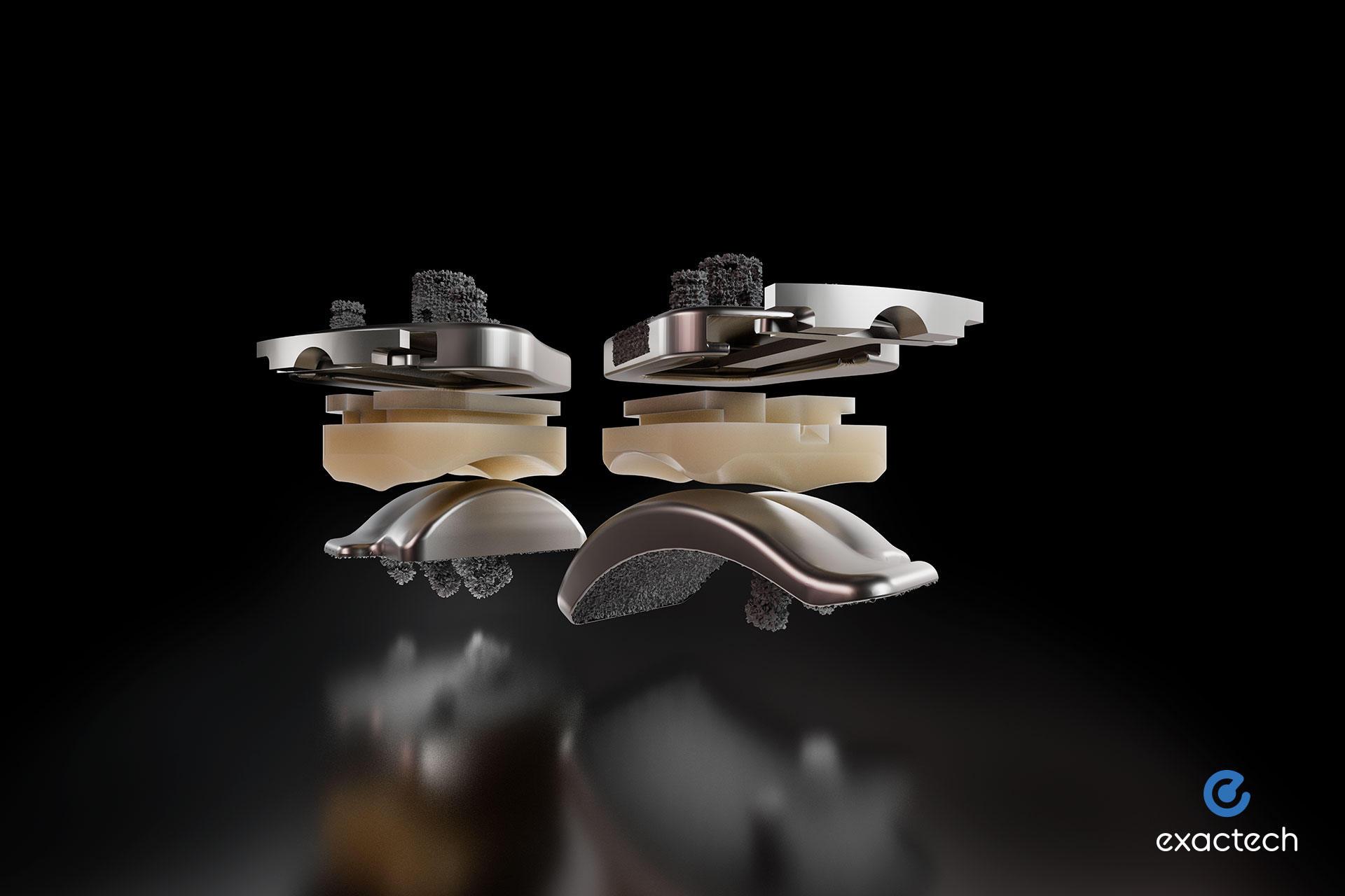 Advita Vantage Ankle Surgeries with Advanced Activit-E Polyethylene