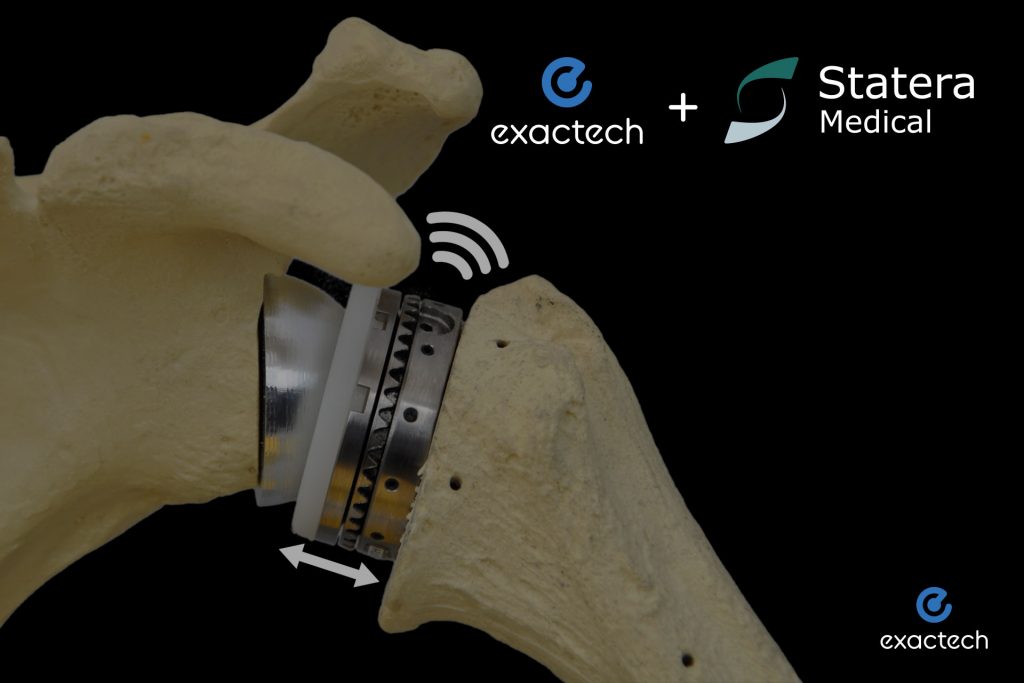 Advita Partners with Statera Medical to Co-Develop World’s First Smart Reverse Shoulder Implant