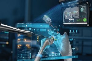 Advita Shoulder Planning App and GPS Shoulder. First and only shoulder navigation technology that connects the preoperative plan with real-time intraoperative instrument guidance and verifies implant placement.