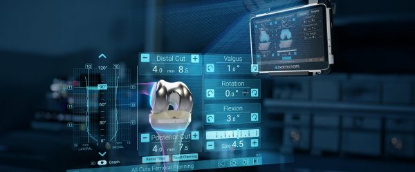 Advita Newton Balanced Knee System with GPS Knee Technology