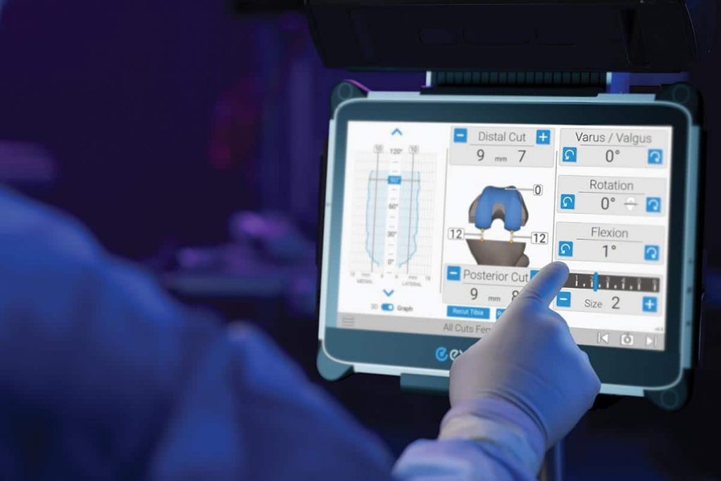 Advita Ortho Knee GPS Newton