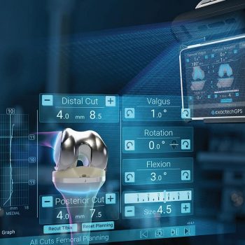 Advita Ortho Newton Balanced Knee System