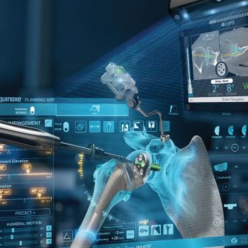 Advita Ortho Equinoxe Planning App and GPS Shoulder