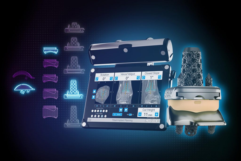 GPS Navigation for Ankle Surgery