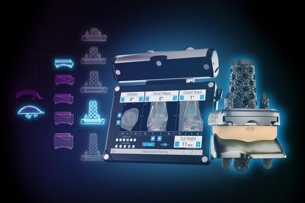 GPS Navigation for Ankle Surgery