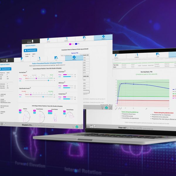 Groundbreaking Research in AI and Personalized Surgical Technologies Predict+
