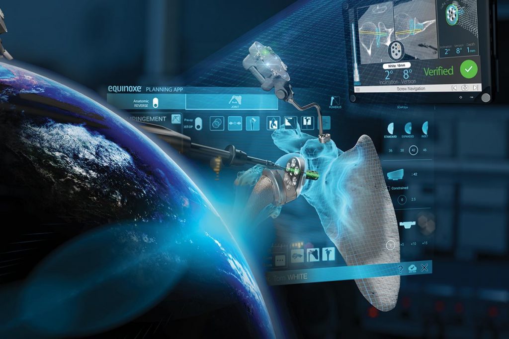 GPS Shoulder Gains Momentum as Utilization Surges