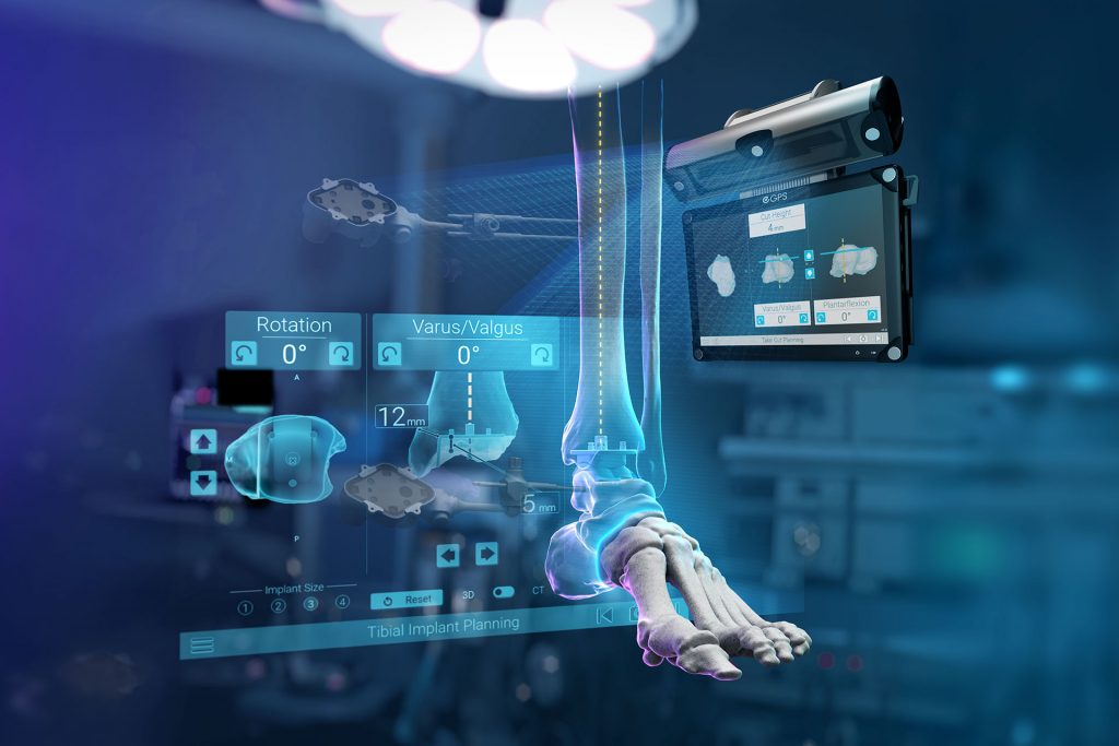 Global Milestone Using Industry-First Ankle Navigation Technology GPS