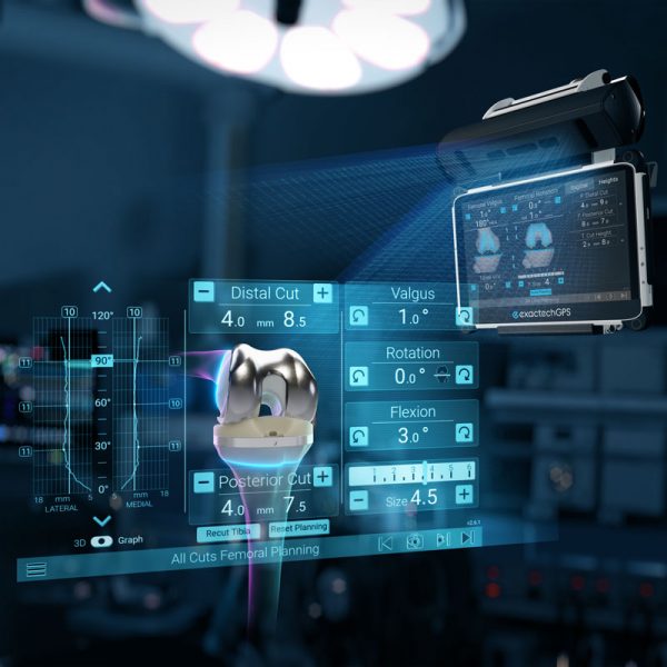 Groundbreaking Research in AI and Personalized Surgical Technologies GPS Knee