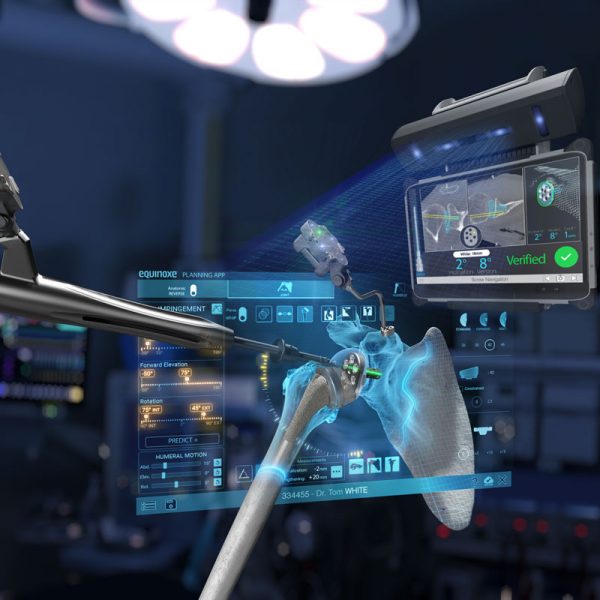 Groundbreaking Research in AI and Personalized Surgical Technologies GPS Shoulder