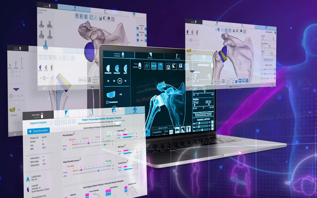 Next-Generation Shoulder Planning App with Advanced Surgical Features