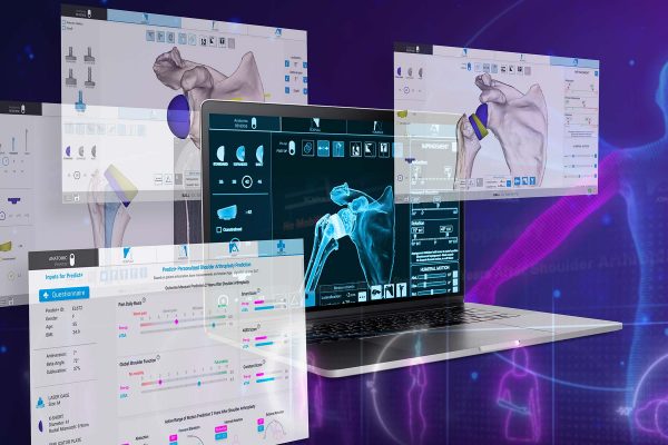 Next-Generation Shoulder Planning App with Advanced Surgical Features