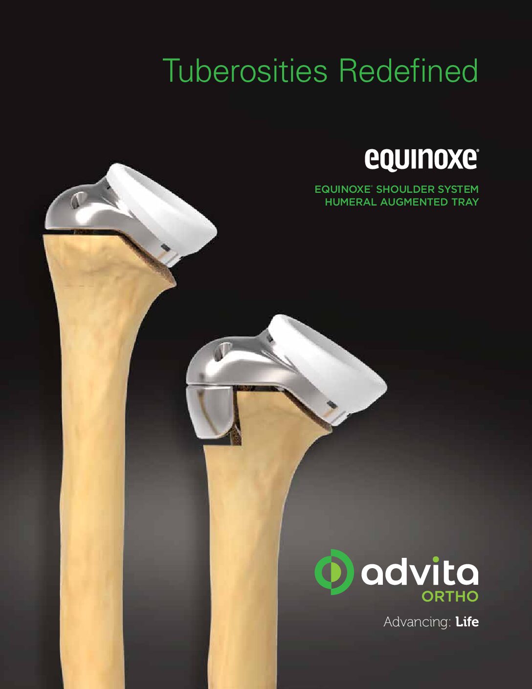 Shoulder Equinoxe Humeral Augmented Tray Product Sheet US