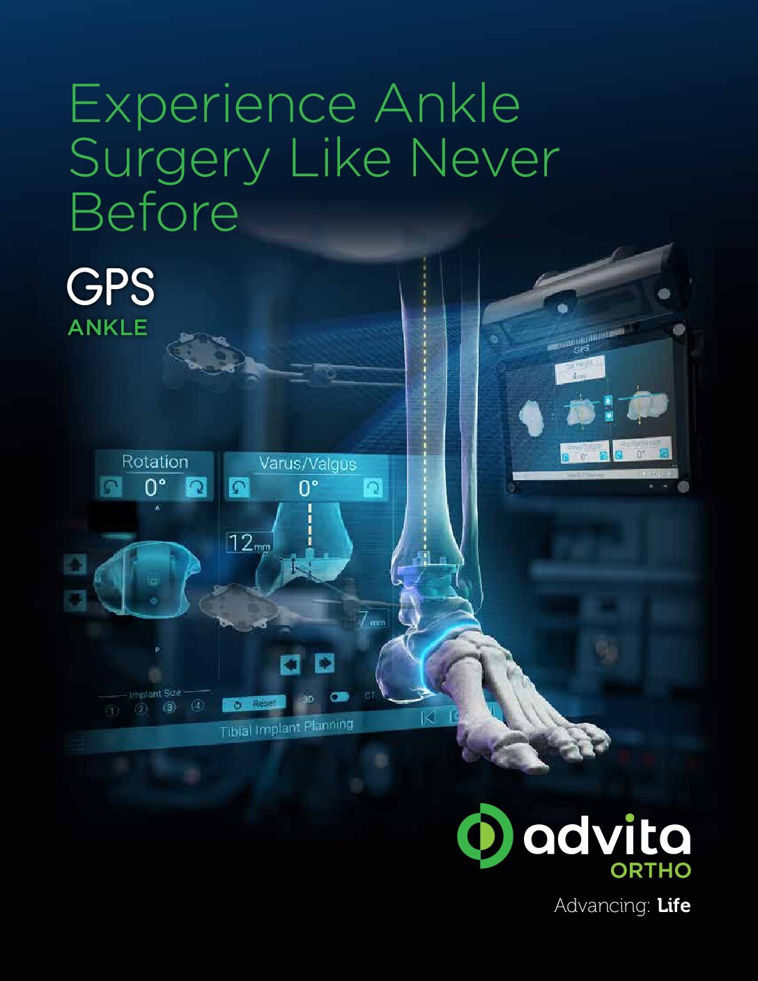 GPS Ankle Product Sheet US