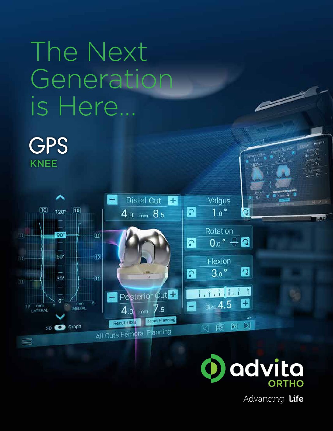 GPS Knee V3 Station Product Sheet US