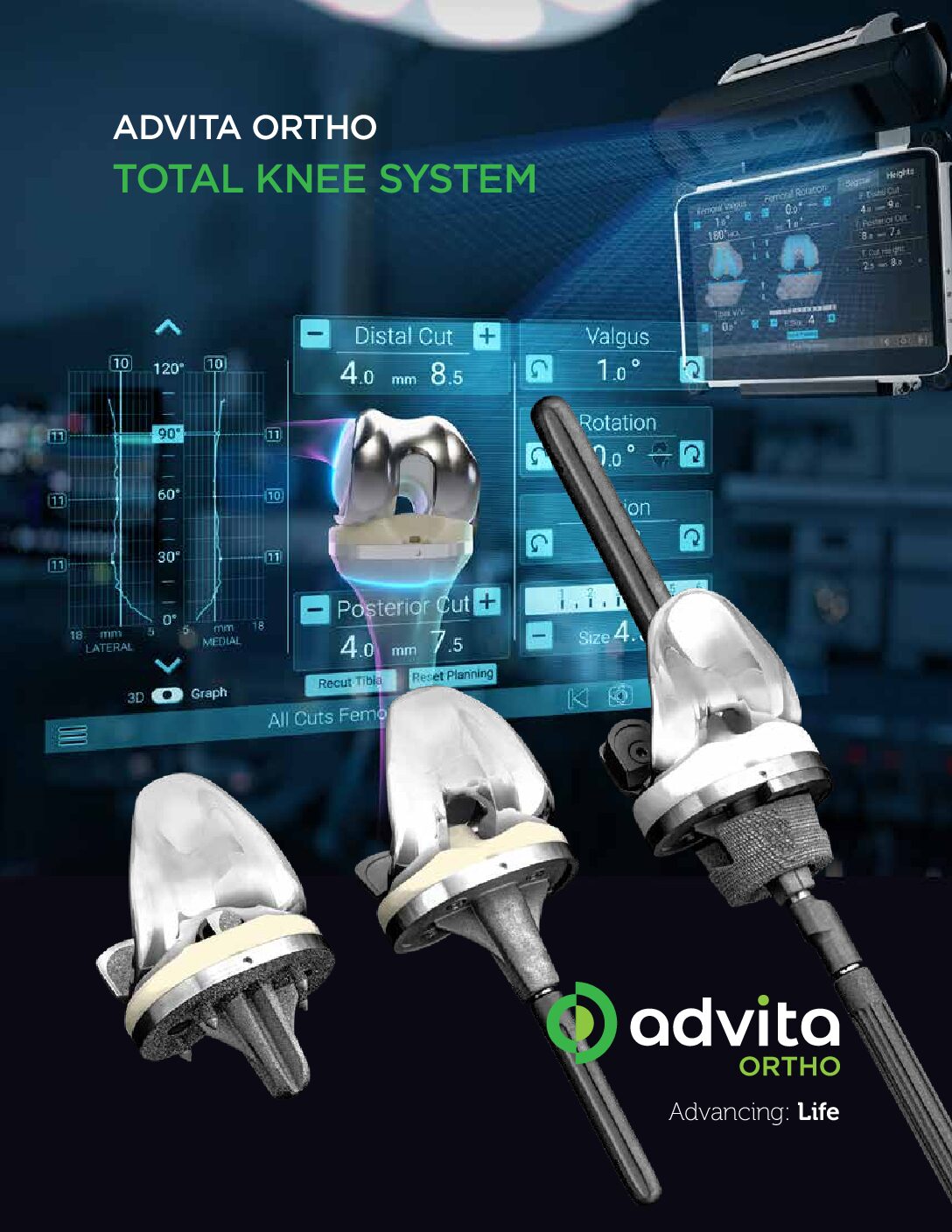High Technology Knee System Product Sheet