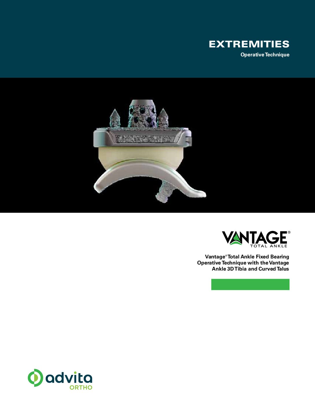 Vantage Total Ankle Fixed Bearing System with 3D Tibia Curved Talus