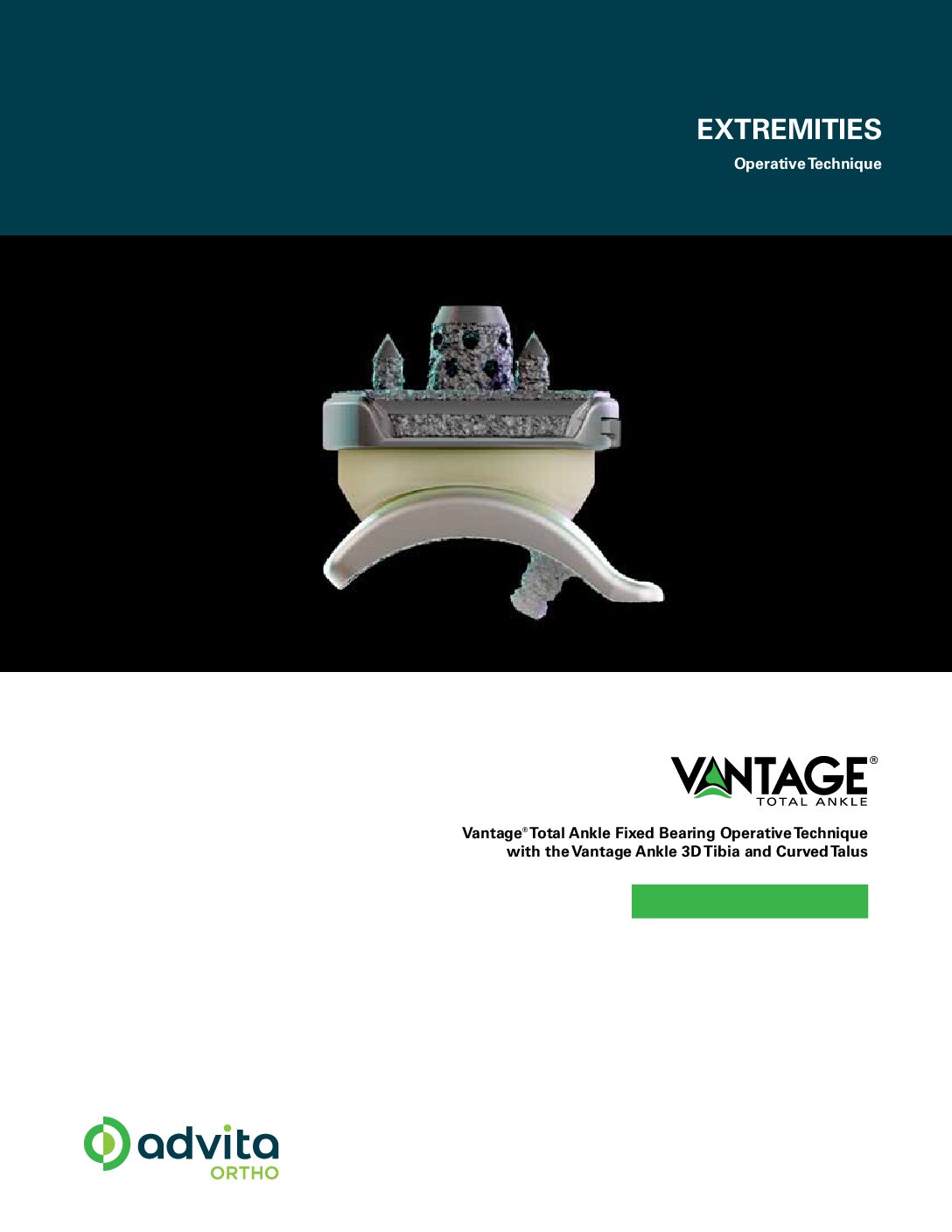 Vantage Total Ankle Fixed Bearing System with 3D Tibia Curved Talus