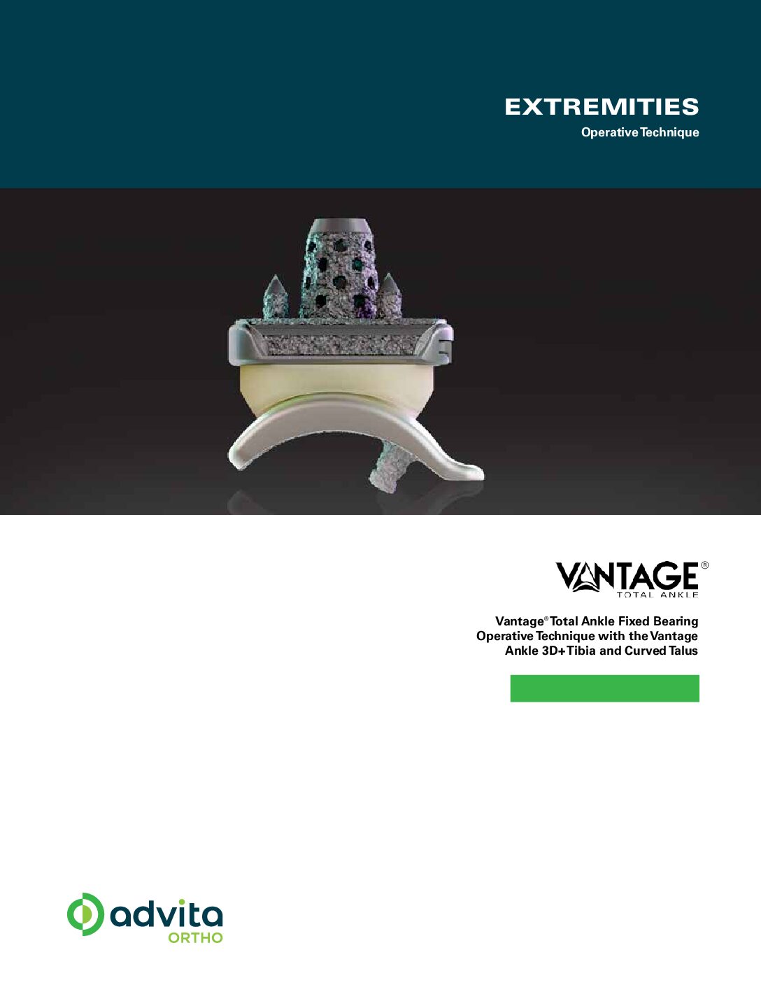 Vantage Ankle Fixed Bearing 3D+ Tibia Curved Talus Operative Technique