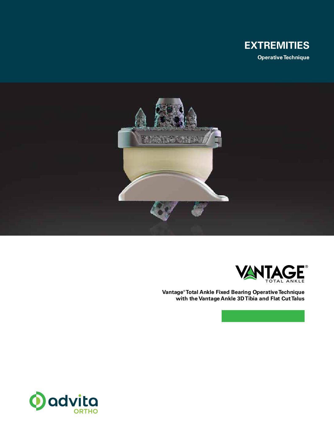 Vantage Ankle 3D Tibia Flat Cut Talus Operative Technique