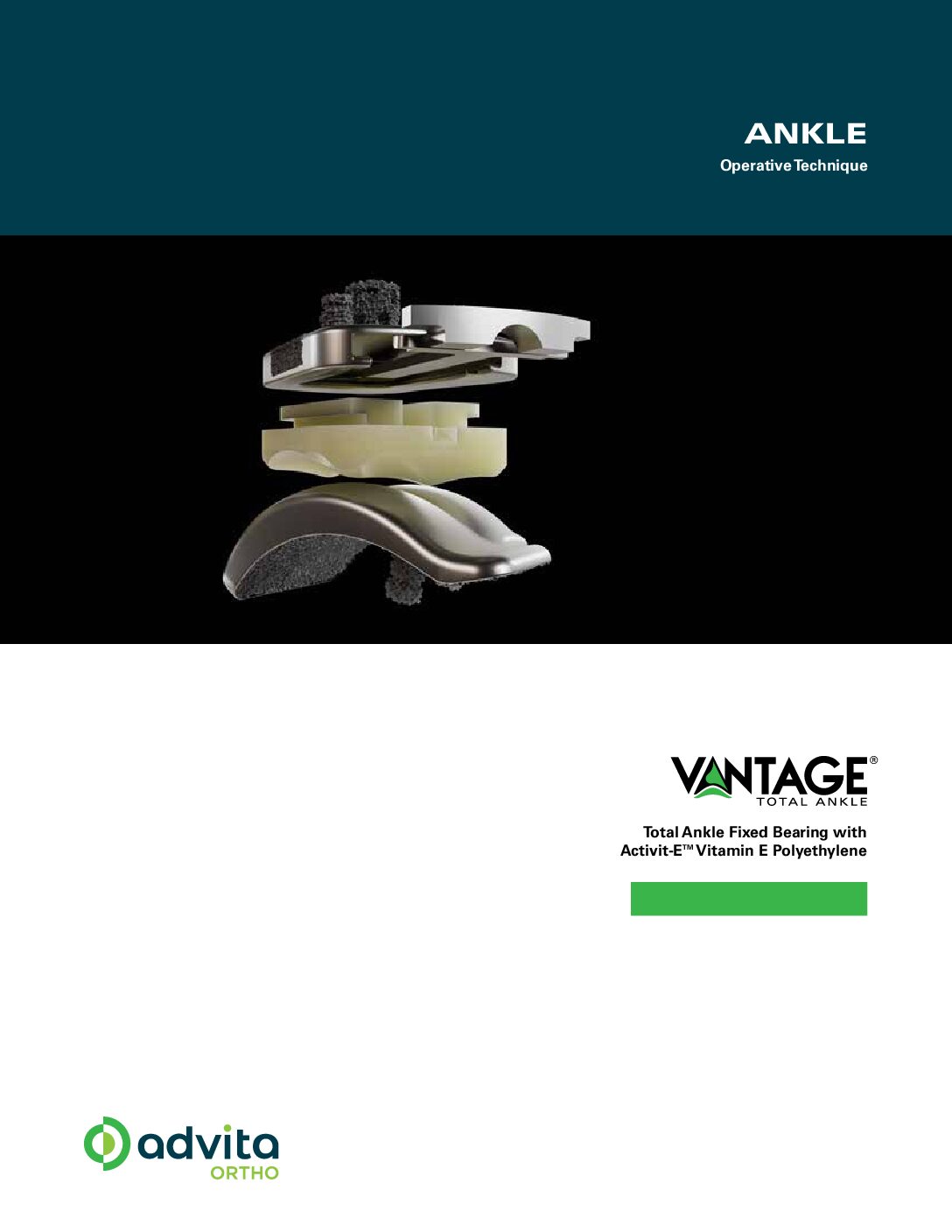 Vantage Ankle Fixed Bearing Operative Technique with Activit-E