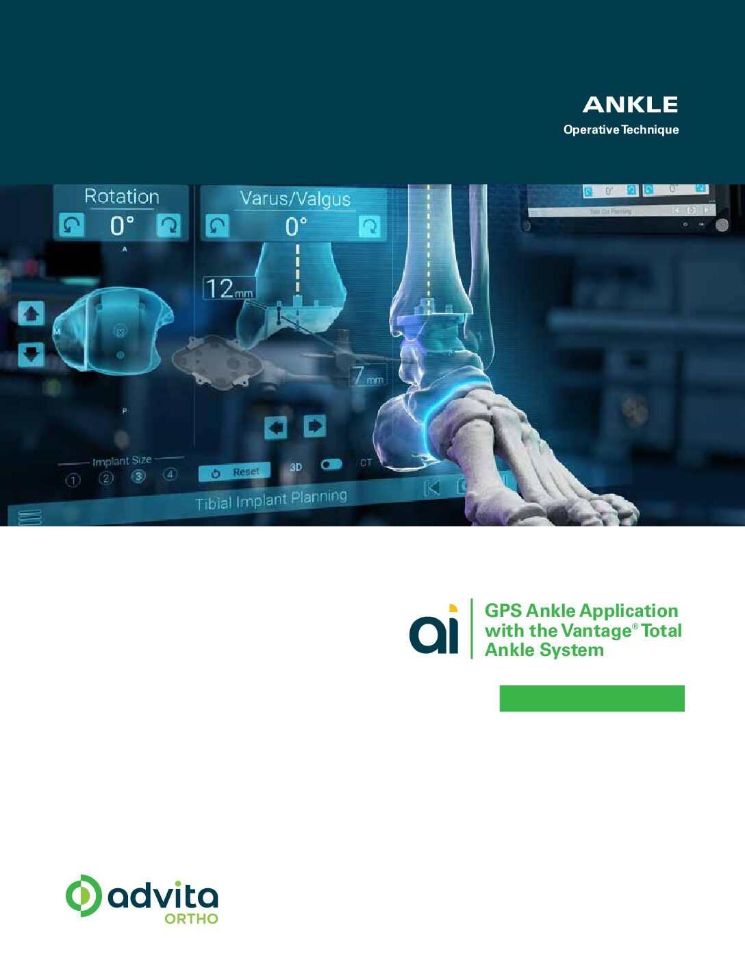 GPS Ankle Operative Technique