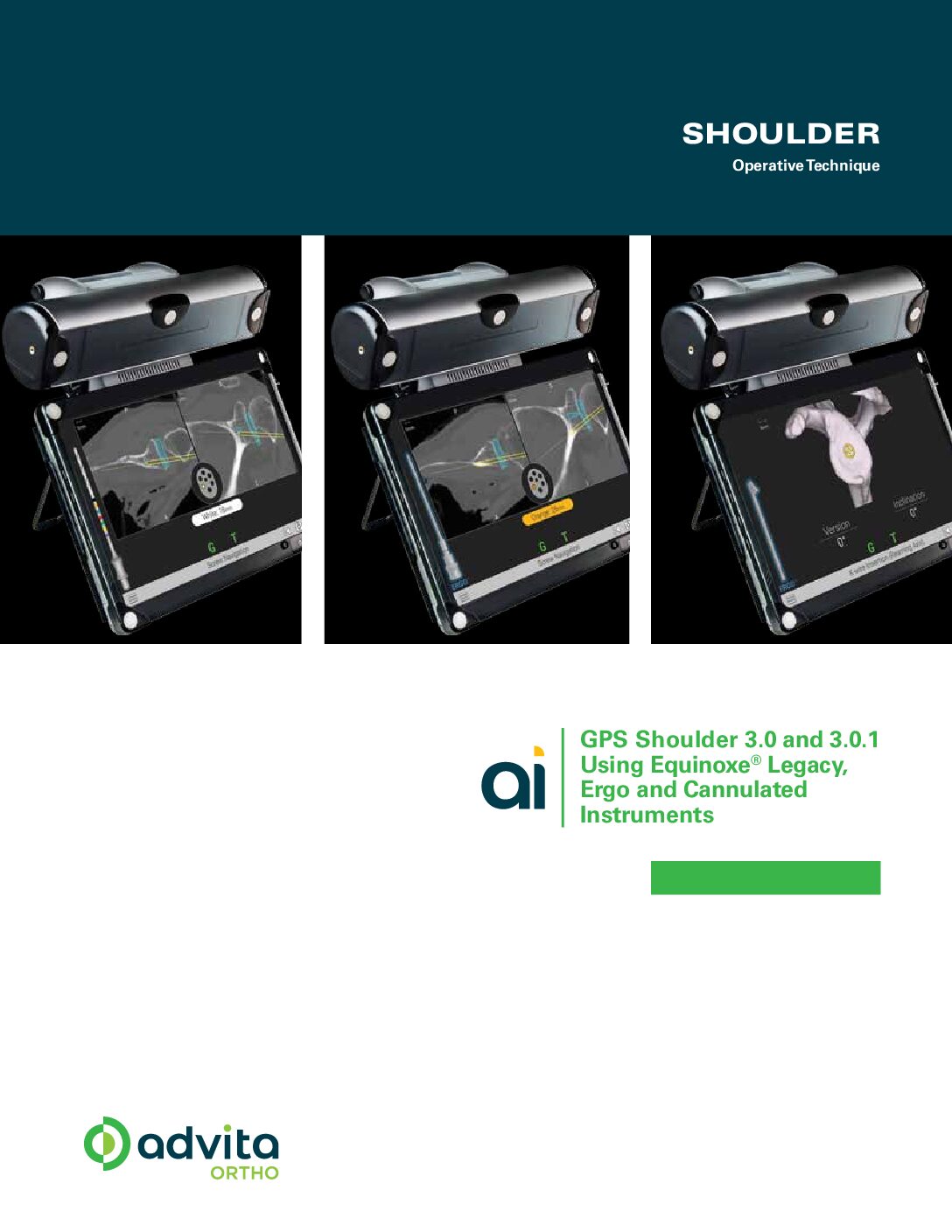 GPS Shoulder Consolidated Operative Technique 3.0, 3.0.1