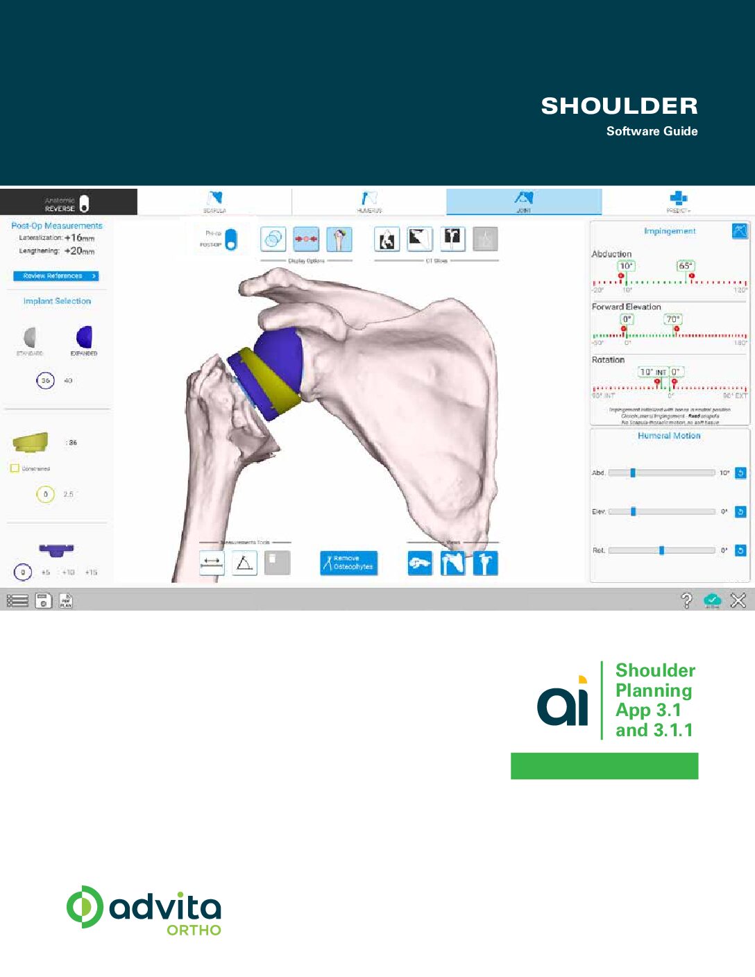GPS Shoulder Planning App Software Guide 3.1, 3.1.1