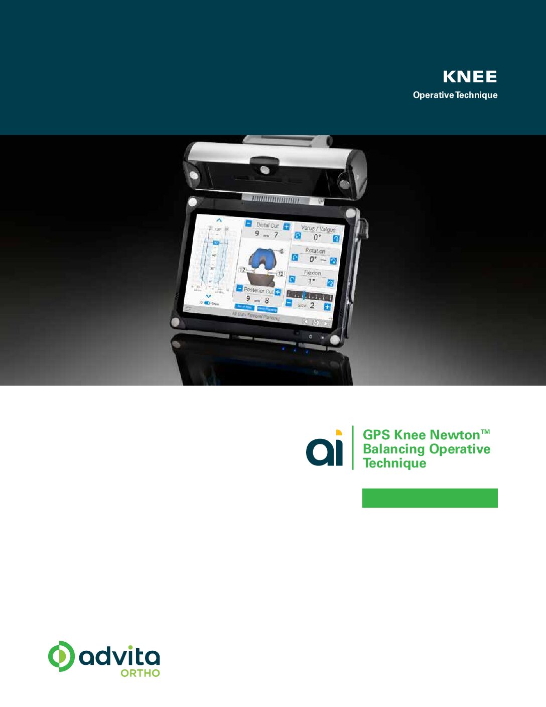 Newton Operative Technique