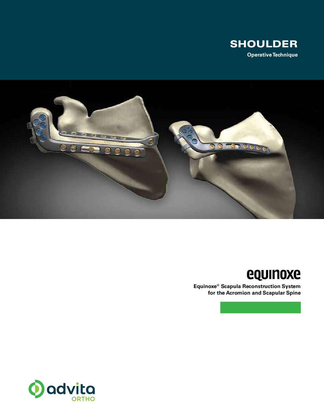 Equinoxe Scapula Reconstruction System Operative Technique