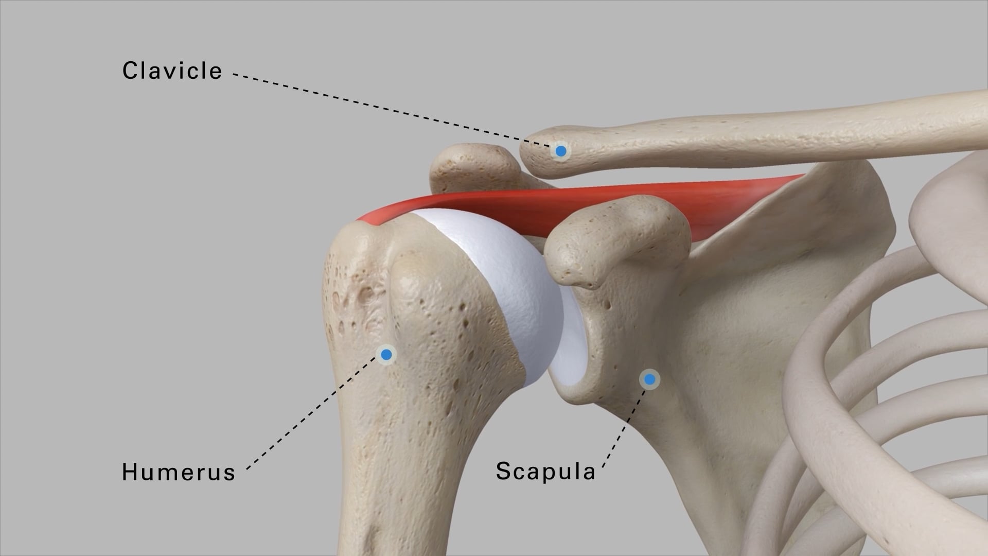 Understanding Reverse Shoulder Replacement Patient Animation