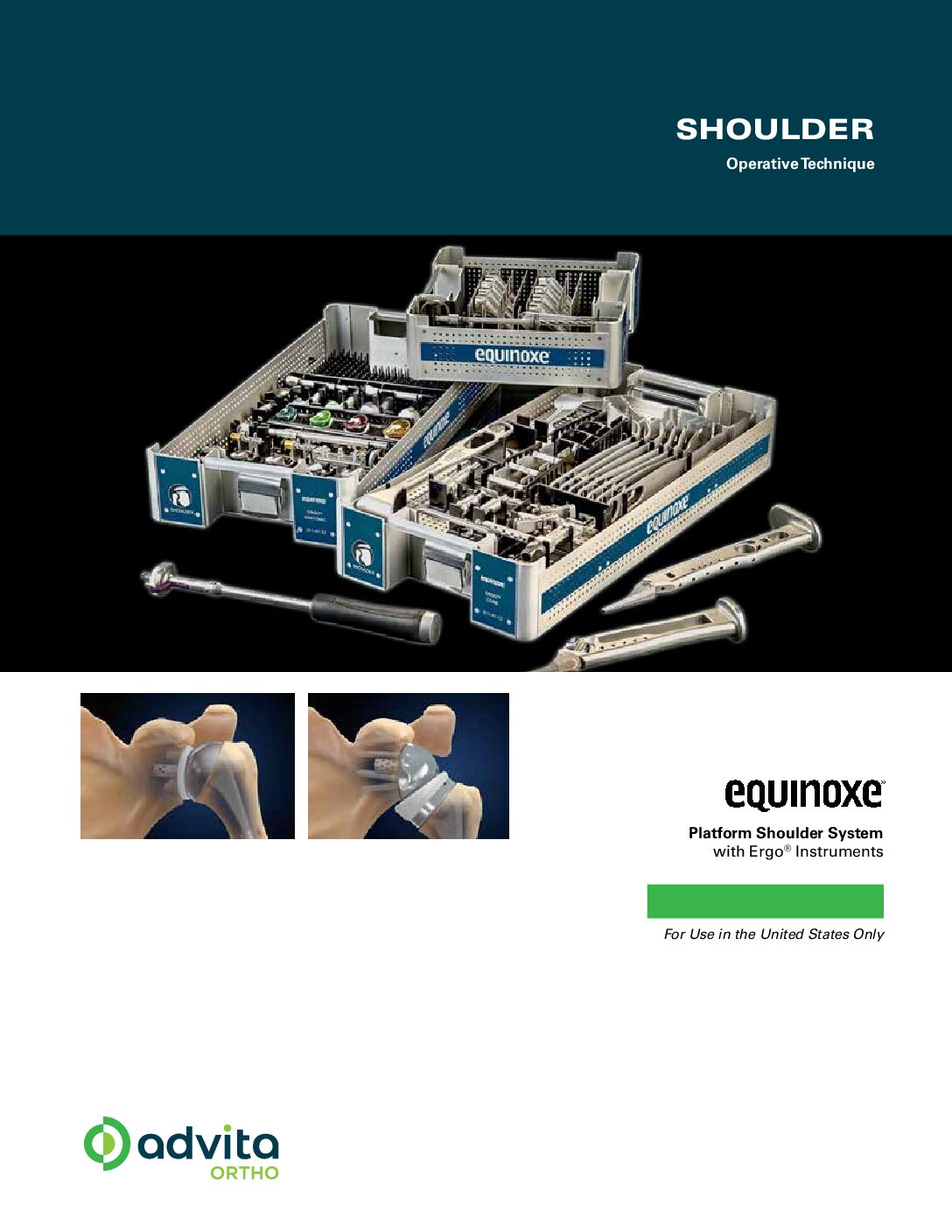 Equinoxe Primary Reverse with Ergo Operative Technique