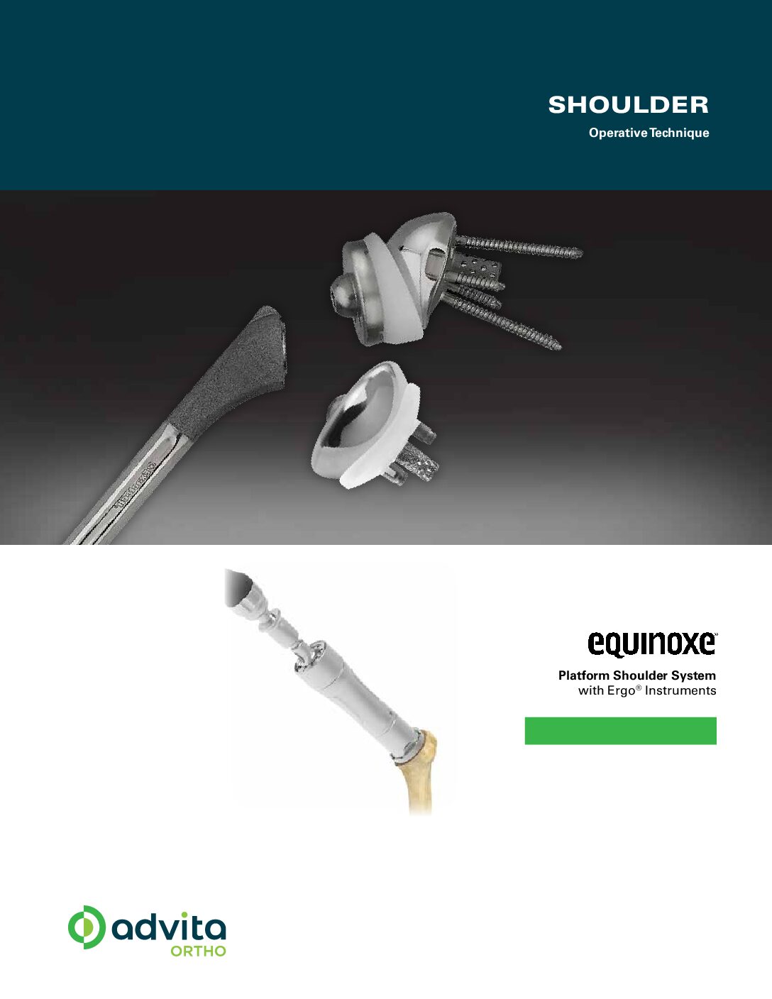 Equinoxe Ergo Primary Reverse Operative Technique