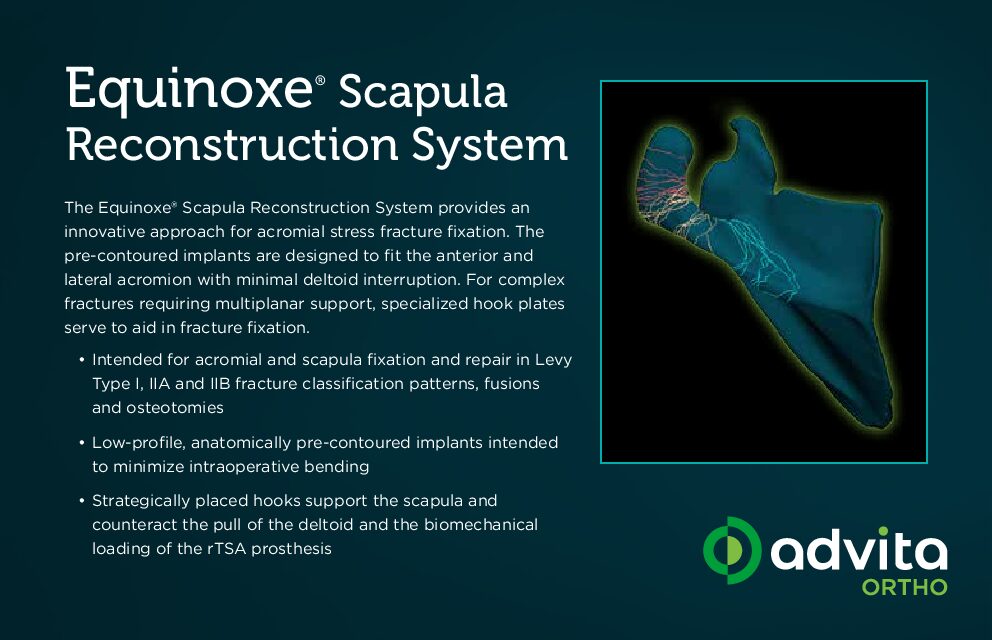 Equinoxe Scapula Reconstruction System Info Card