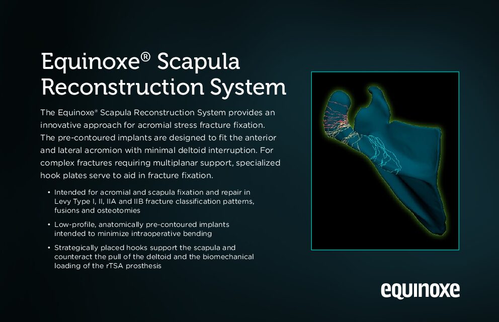 Equinoxe Scapula Reconstruction System Info Card