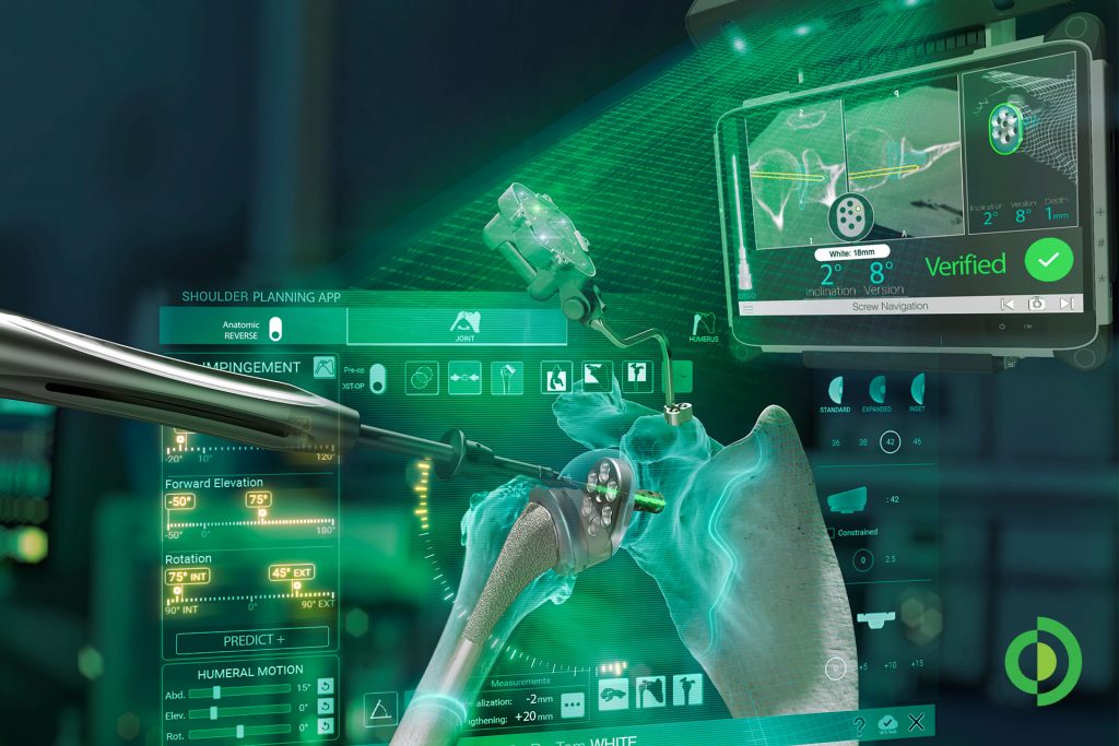 Advita Ortho Expands Navigation Platform with Next-Generation GPS Shoulder System