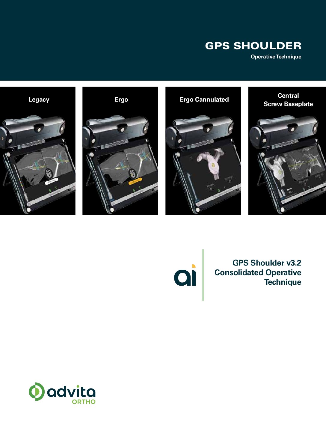 GPS Shoulder v3.2 Operative Technique