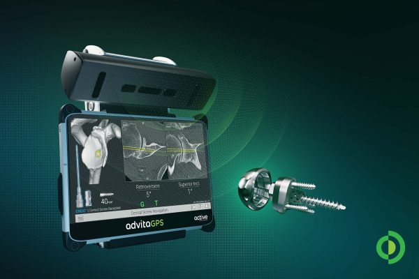 Advita Ortho Announces First GPS-Guided Shoulder Case with Central Screw Baseplate