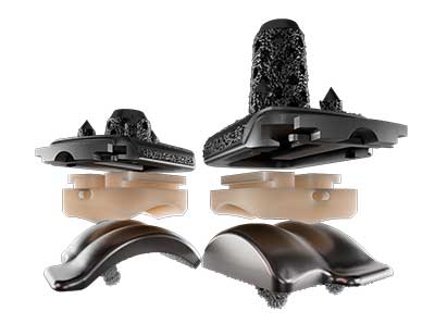 Vantage® Total Ankle System and its new advanced Activit-E™ vitamin E polyethylene